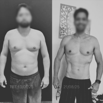 Antes x Depois - Dr. Bruno 1