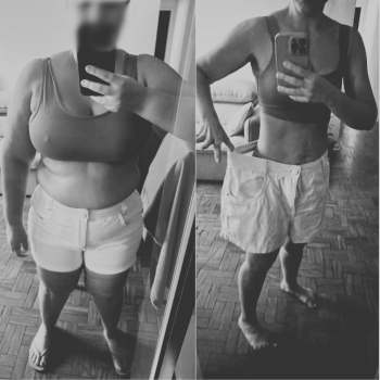 Antes x Depois - Dr. Bruno 2