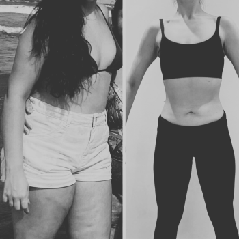 Antes x Depois - Dr. Bruno 5