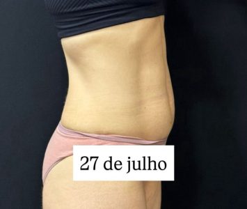 resultados_dr.bruno_beteloni_4
