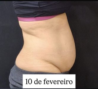 resultados_dr.bruno_beteloni_5
