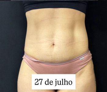 resultados_dr.bruno_beteloni_6