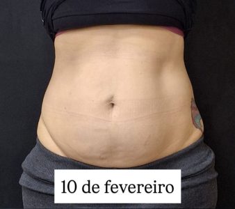 resultados_dr.bruno_beteloni_7